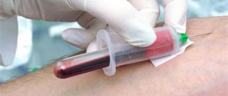 Анализ крови на коагулограмму – лабораторный тест, включающий комплекс показателей свертываемости.