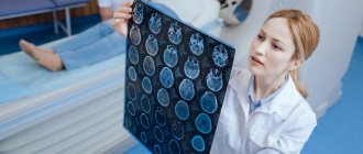 Киста головного мозга у взрослых. Фото: Shutterstock