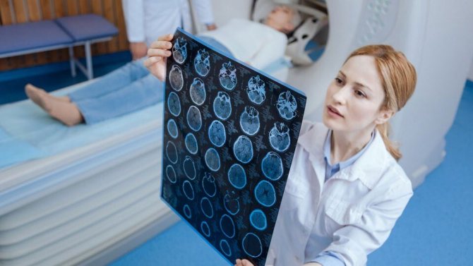 Киста головного мозга у взрослых. Фото: Shutterstock