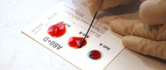 Лаборант определяет группу крови
