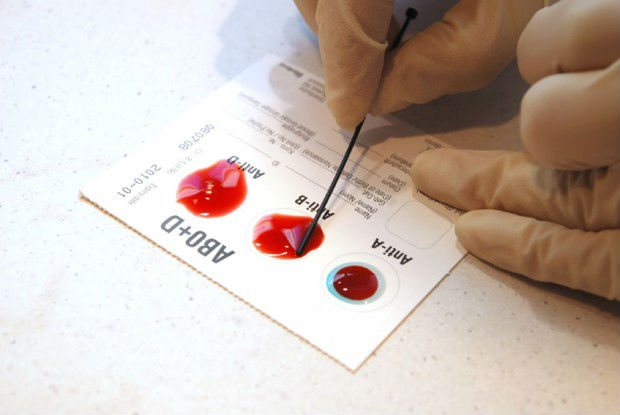 Лаборант определяет группу крови