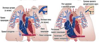 легочное-сердце