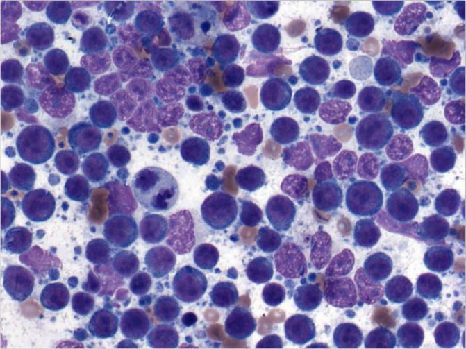 Лейкоциты в мазке крови