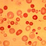 Мазок крови под микроскопом