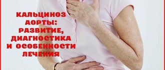 Механизм развития, диагностика и лечение кальциноза аорты