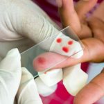 Может ли меняться группа крови в течение жизни: реально ли ее изменение после переливания? Понятие о ГК и РФ
