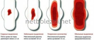 Норма выделений при менструации