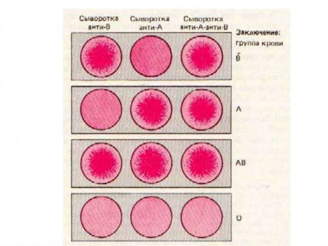 Определение группы крови цоликлонами