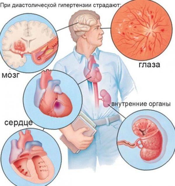 Органы которые страдают от диастолической гипертензии