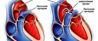 Открытый артериальный проток. Что это? | ВКонтакте