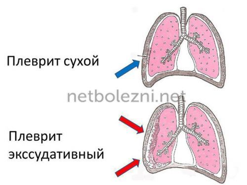 Патологии дыхательной системы