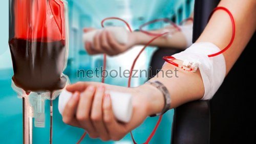 Переливание крови для лечения