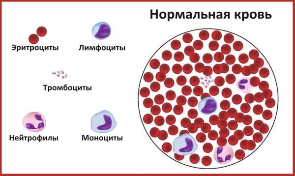 Повышенные тромбоциты в крови у женщин. Причины и лечение, что это значит