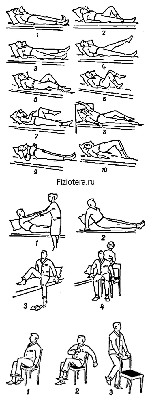 Примеры упражнений ЛФК после инфаркта миокарда