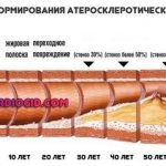 процесс формирования атеросклеротической бляшки