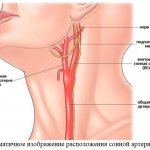 Схематичное изображение расположения сонной артерии