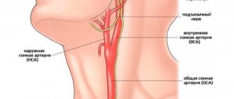 Схематичное изображение расположения сонной артерии