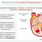 Синусовая брадиаритмия сердца у ребенка, подростка. Что это такое, занятия спортом